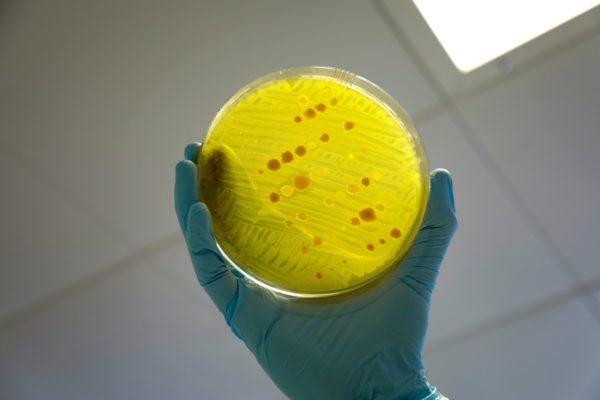 A gloved hand holding up a petri dish